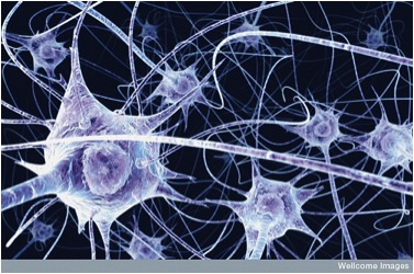Image credit: Benedict Campbell. Wellcome Images